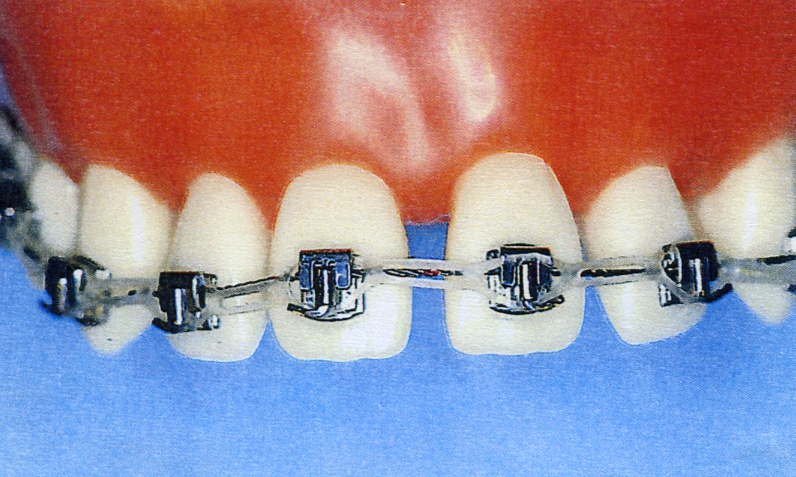 dentalimage